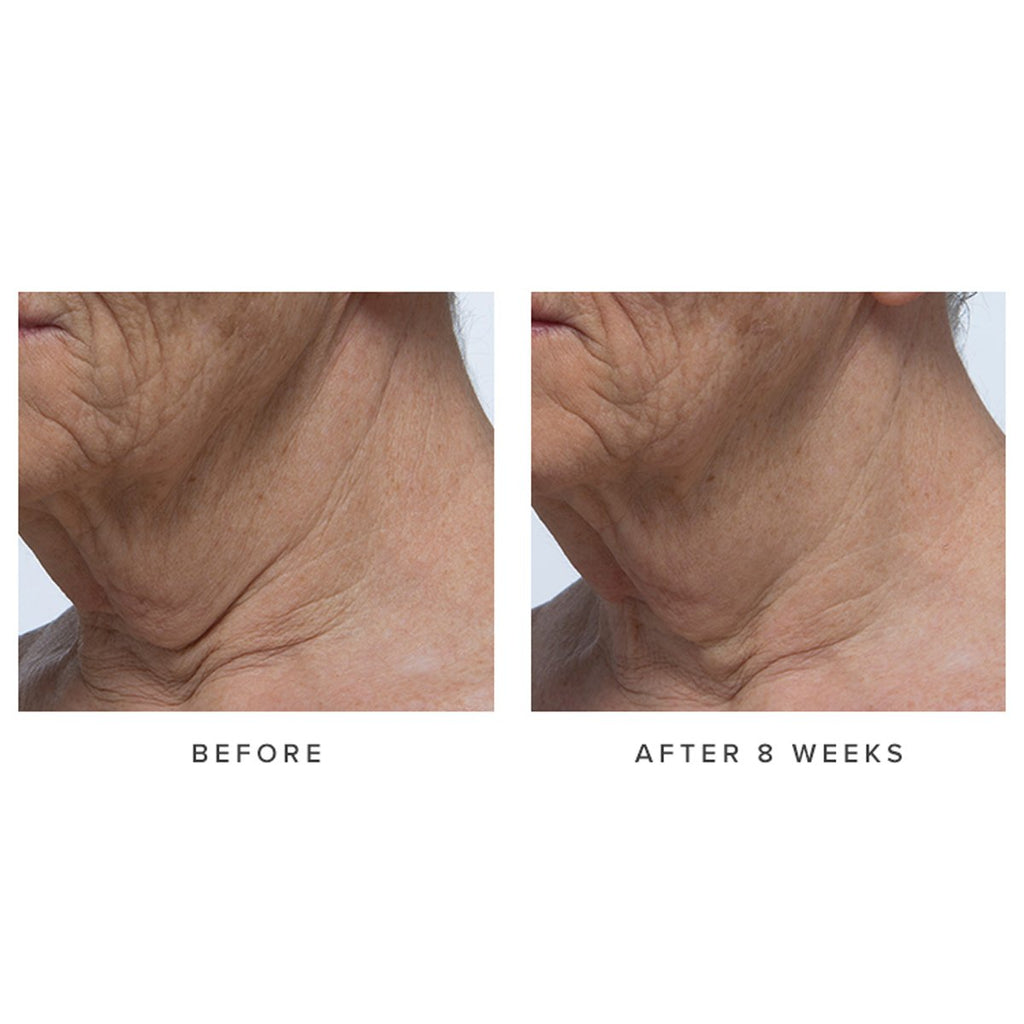 Ageless Revitalizing Neck Cream