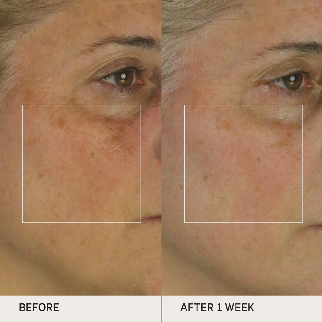 The Brightening Serum